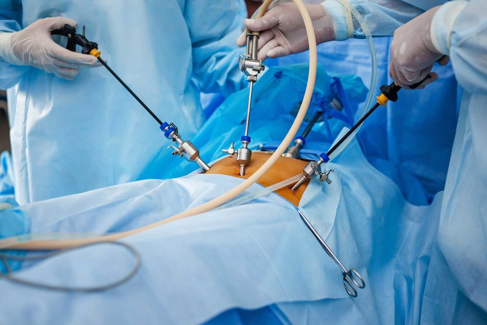 Minimally Invasive Urology